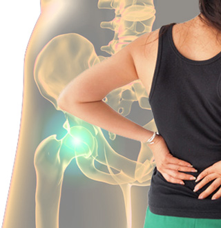 Arthritis of the hip