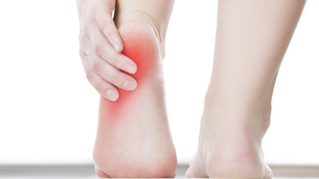Heel spur