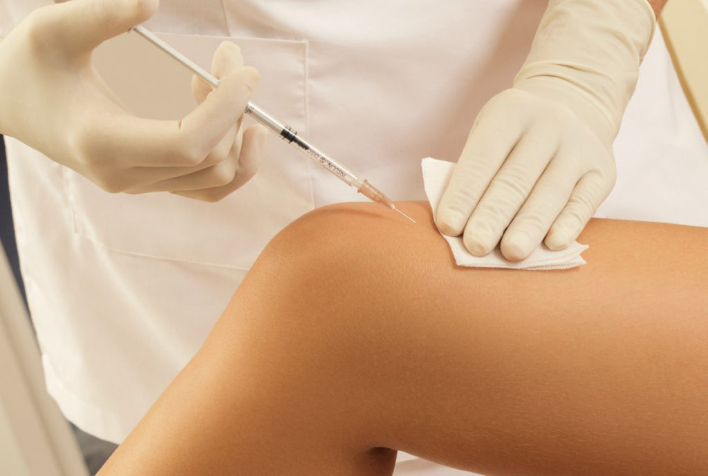 Steroid Injection