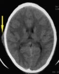 111 3