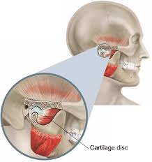 Çene kemiğinin kafatasına nasıl bağlandığını gösteren temporomandibular eklem diyagramı