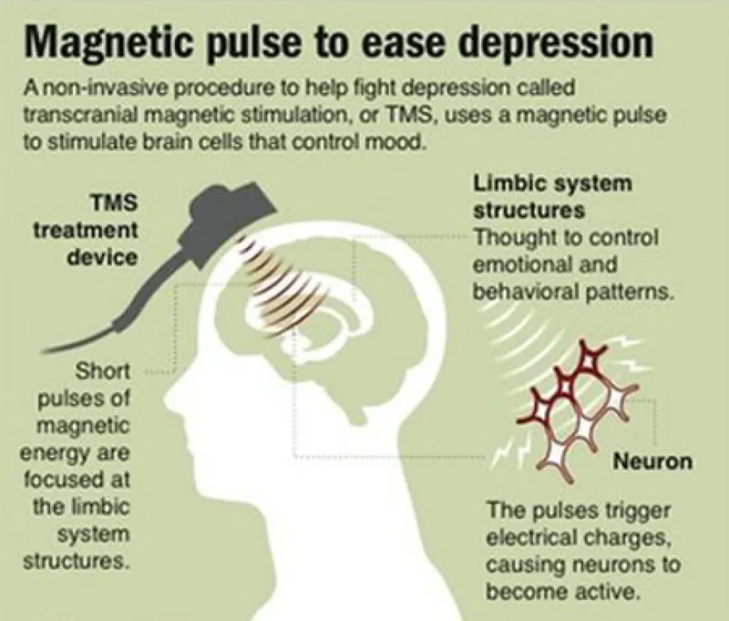 TMS study results for neuropsychiatric disorders